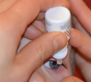 Zyclora est un médicament antiviral utilisé contre l'herpès simplex (HSV). Sa formule contient de l'aciclovir.