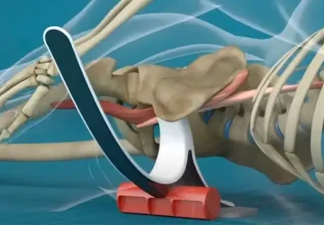For millions of people, muscle tension is an unavoidable reality, often leading to chronic pain, stiffness, and reduced mobility. Whether caused by stress, poor posture, or repetitive movements, this tension can significantly impact daily life. Traditional pain relief solutions, such as medication or massage, may offer temporary relief, but they often fail to address the root cause of discomfort. Enter Aletha Health’s ‘The Set’—an innovative, science-backed approach designed to tackle muscle tension at its core. By combining targeted techniques with easy-to-use tools, ‘The Set’ empowers individuals to take control of their pain and achieve long-lasting relief naturally.